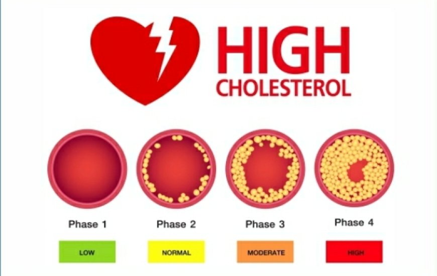 The Silent Threat of High Cholesterol in Young Adults